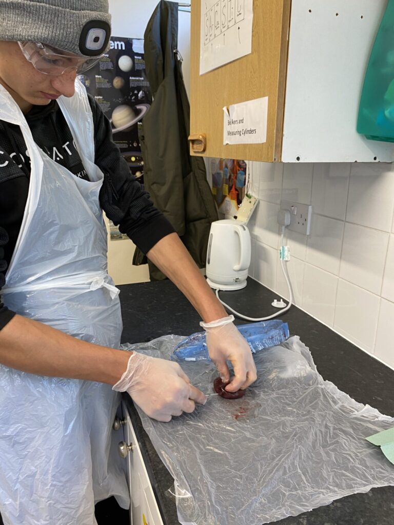 RH dissecting a kidney 1