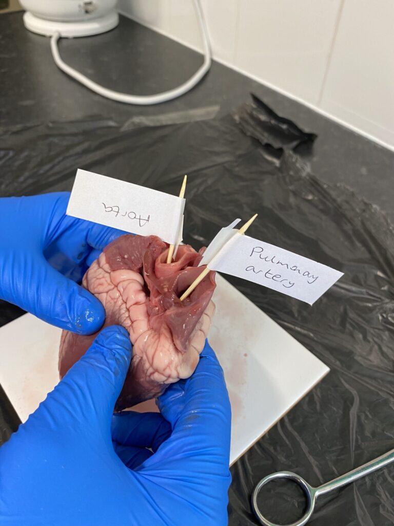 RNM heart dissection 1 (1)